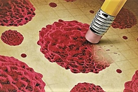Έλληνας γιατρός στις ΗΠΑ: Η χημειοθεραπεία είναι δυνατό να επιδεινώσει τον καρκίνο